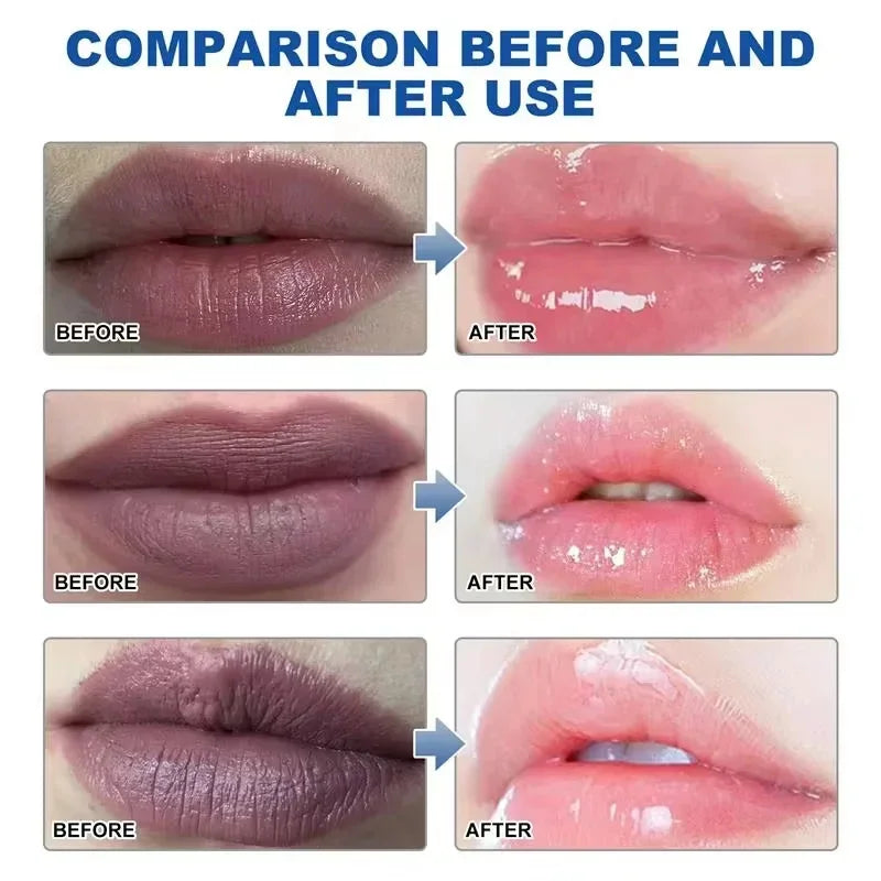 Remove Dark Lip Balm Fast Lightening Pink Exfoliating Fade Lip Line Dead Skin Moisturizer Korean Beauty Care