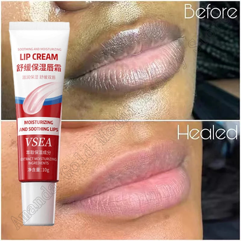 Remove Dark Lip Balm Fast Lightening Pink Exfoliating Fade Lip Line Dead Skin Moisturizer Korean Beauty Care