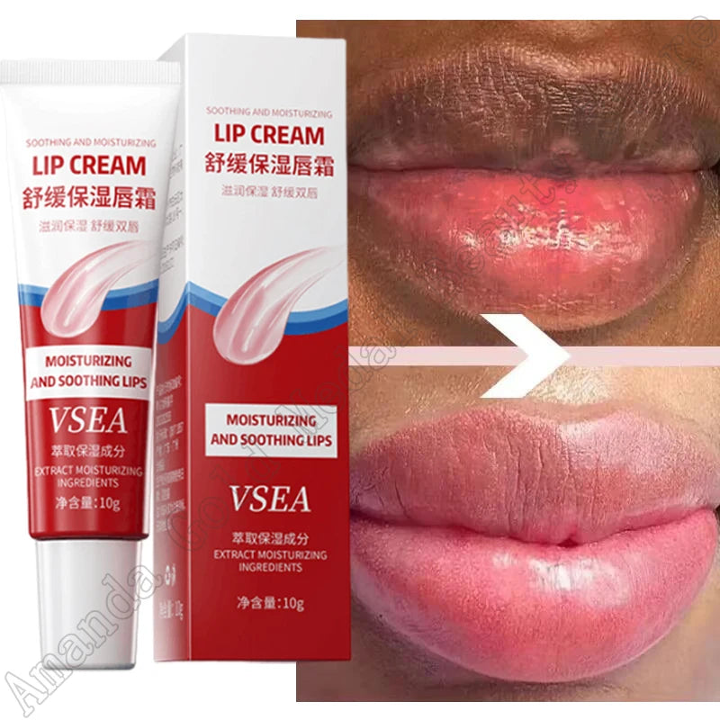Remove Dark Lip Balm Fast Lightening Pink Exfoliating Fade Lip Line Dead Skin Moisturizer Korean Beauty Care
