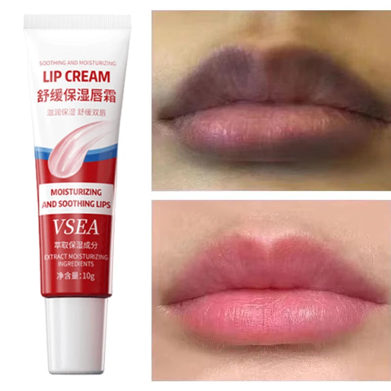 Remove Dark Lip Balm Fast Lightening Pink Exfoliating Fade Lip Line Dead Skin Moisturizer Korean Beauty Care